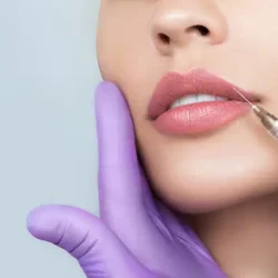 Facial Procedures Before & After Gallery